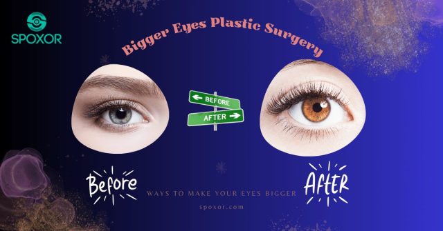 Bigger Eyes Plastic Surgery