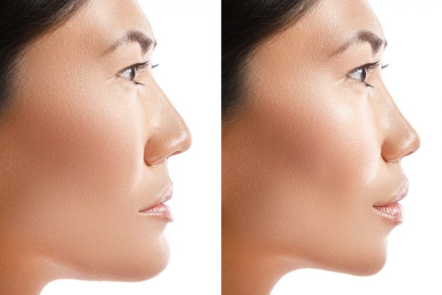 High Cheekbones vs Low Cheekbones & How You Can Improve Them